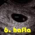 Gebelikte-6-Hafta_83ea3.jpg