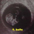 Gebelikte-9-Hafta_911de.jpg